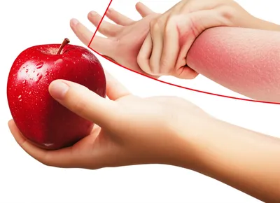 Illustration inflammatory