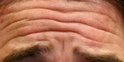 Illustration wrinkled - Image 2