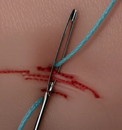 Illustration suturing