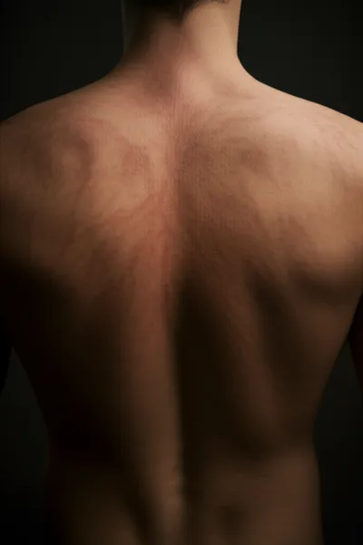 Illustration lacing - Image 1