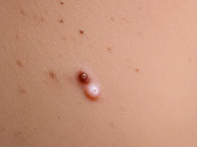 Illustration blotches - Image 1