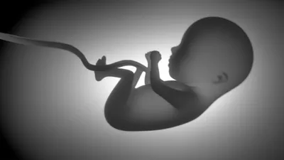 Illustration abortion - Image 1