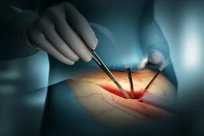 Illustration manoeuvre - Image 1