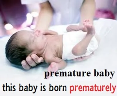 Illustration prematurely - Image 2