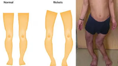 Illustration rickety - Image 2