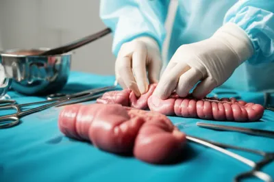 Illustration autopsy - Image 1