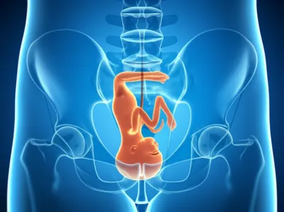 Illustration pelvimetry