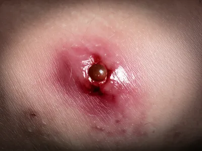 Illustration abs - Image 1