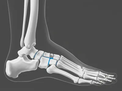 Illustration metatarsal - Image 1