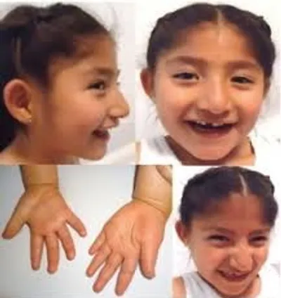 Illustration syndrome - Image 2