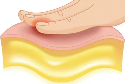 Illustration undulation - Image 1