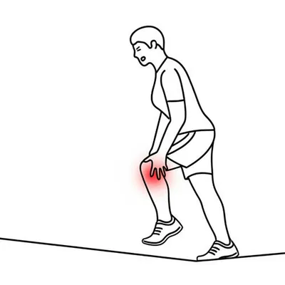 Illustration claudication