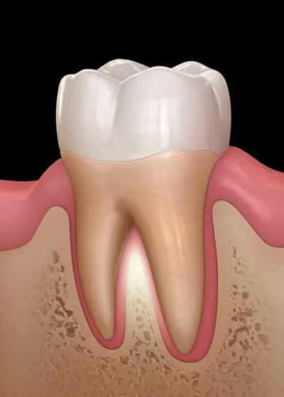 Illustration roots - Image 1