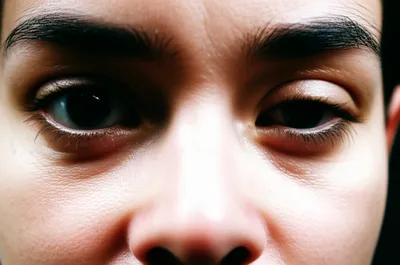 Illustration squinting - Image 1