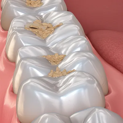 Illustration molars - Image 1