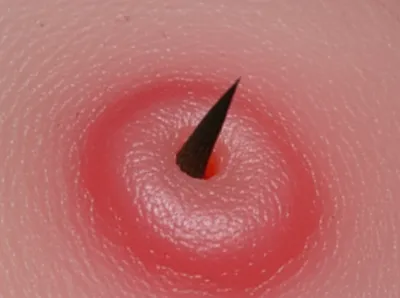 Illustration rankle - Image 1