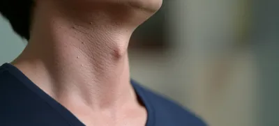 Illustration broke - Image 1