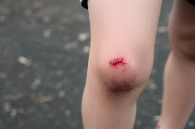 Illustration creasing - Image 1