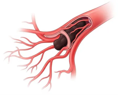 Illustration collateral - Image 1