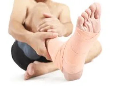 Illustration sprain - Image 2