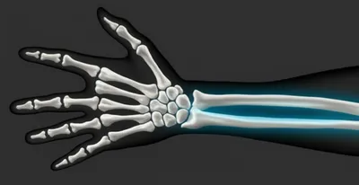 Illustration radial - Image 1