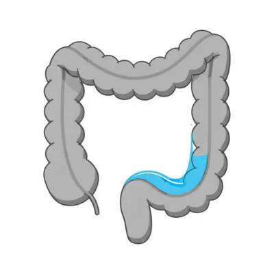 Illustration enema - Image 1