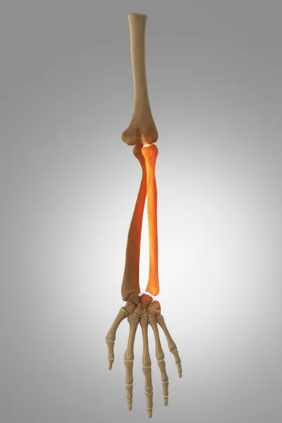 Illustration radii - Image 1