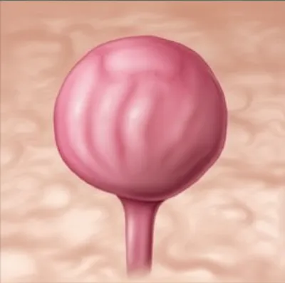 Illustration peduncles - Image 1