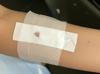 Illustration gauze - Image 1