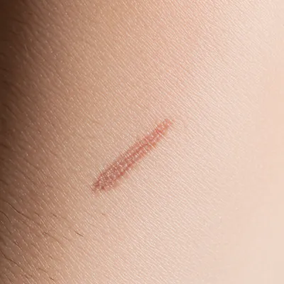 Illustration scar - Image 1