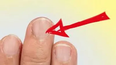 Illustration fingernail - Image 2