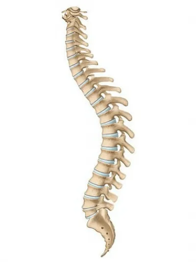 Illustration kyphosis