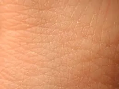 Illustration skin - Image 3