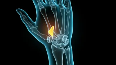 Illustration trapezoid - Image 1