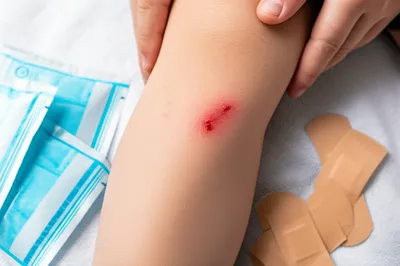 Illustration wounds - Image 1