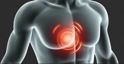 Illustration wind - Image 1