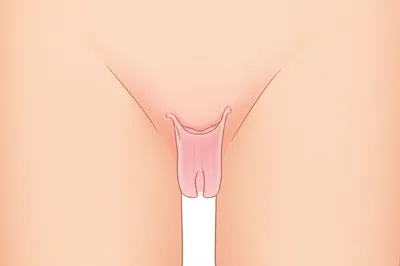Illustration hymen - Image 1