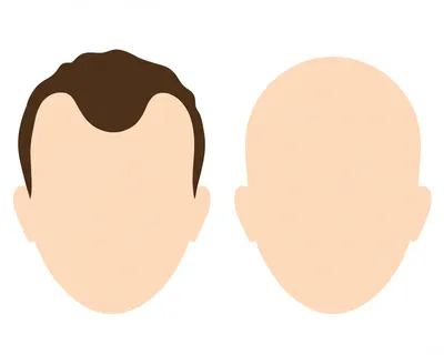 Illustration bald - Image 1