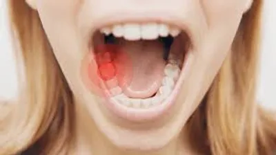 Illustration toothache - Image 2