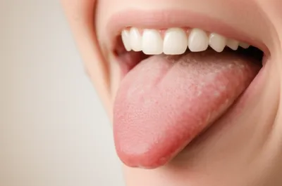 Illustration tap - Image 1