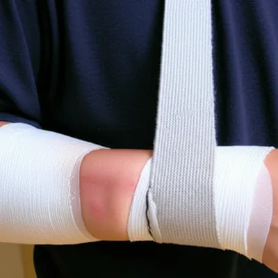 Illustration splints - Image 1