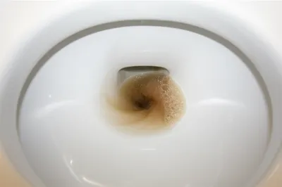 Illustration defecating - Image 1