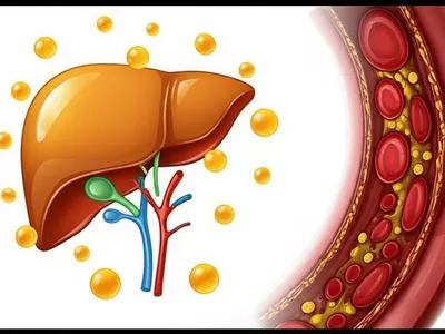 Illustration cholesterol
