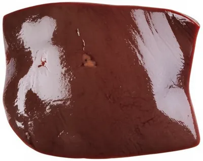 Illustration livers - Image 1