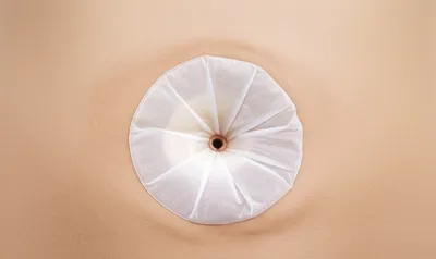 Illustration stomata - Image 1