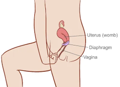 Illustration diaphragm - Image 2