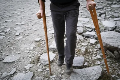 Illustration stilts - Image 1