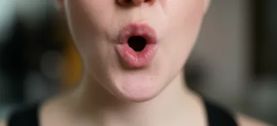 Illustration rounding - Image 1