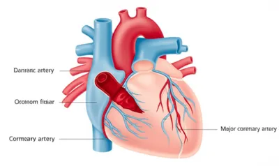 Illustration infarction - Image 1