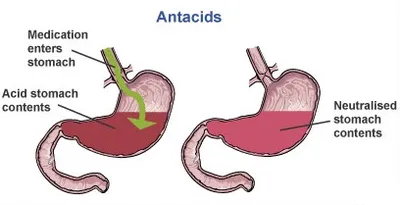 Illustration antacid - Image 2